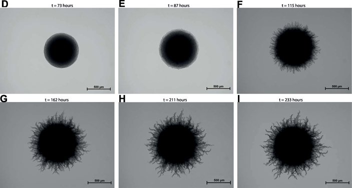 Фотография растущей колонии Saccharomyces cerevisiae в условиях дефицита источника азота. На поздних стадиях роста можно наблюдать образование псевдомицелия