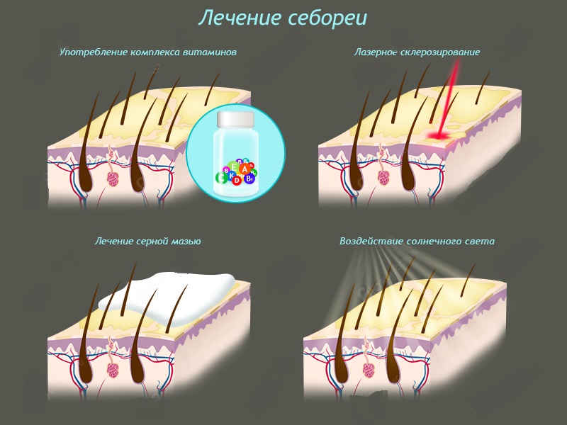 Лечениее заболевания