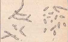 Формы клеток дрожжеподобных грибов рода Кандида