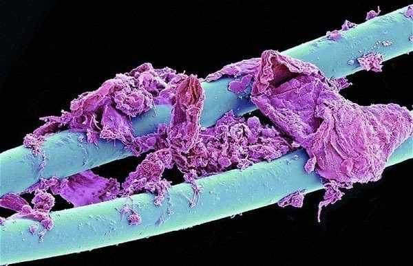 Как выглядит плесень на хлебе под микроскопом. 10 удивительных примеров ...